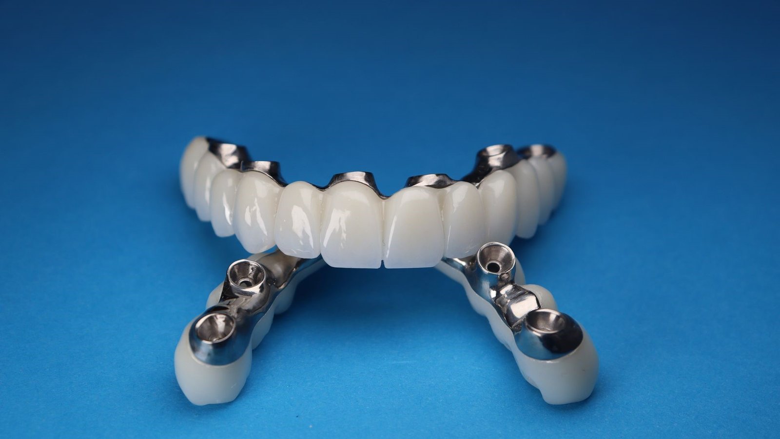 Dental implant treatment